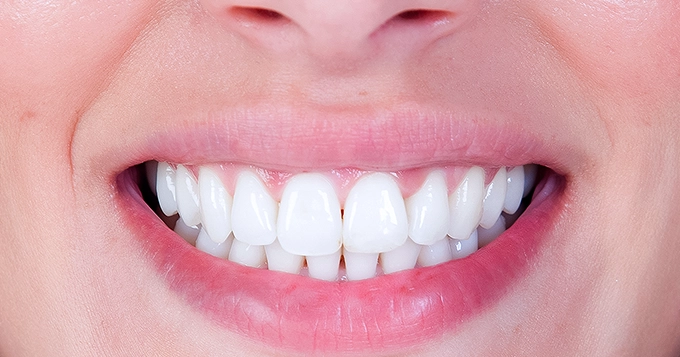 A close-up of someone smiling with their teeth showing | Trainest