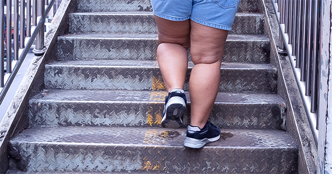 An overweight person walking up the stairs | Trainest 