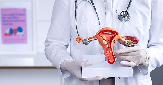 A doctor holding an anatomical model of the female reproductive system | Trainest 